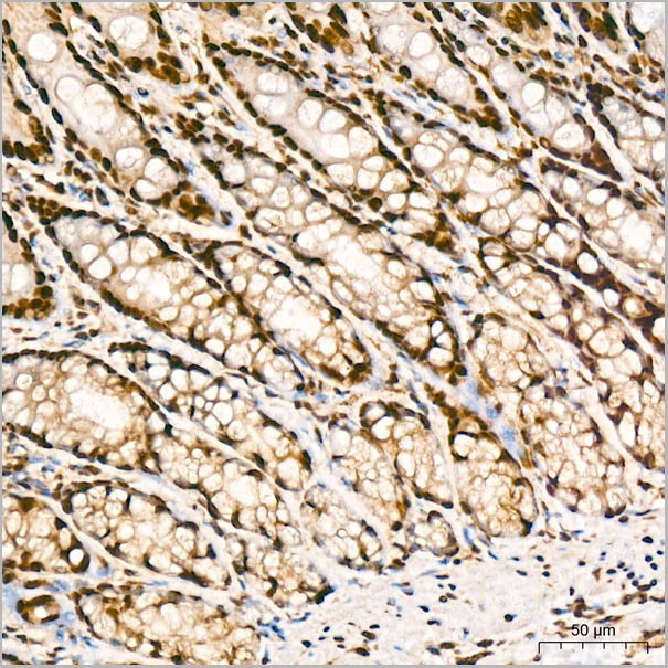 product-image-AAA28572_IHC7.jpg