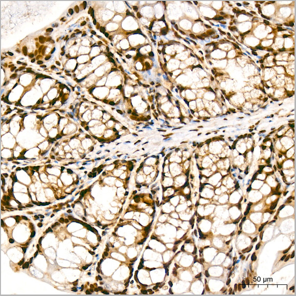 product-image-AAA28572_IHC9.jpg