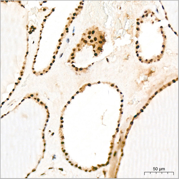 product-image-AAA28573_IHC2.jpg