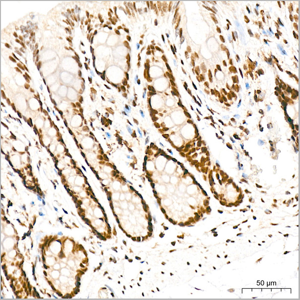product-image-AAA28573_IHC4.jpg