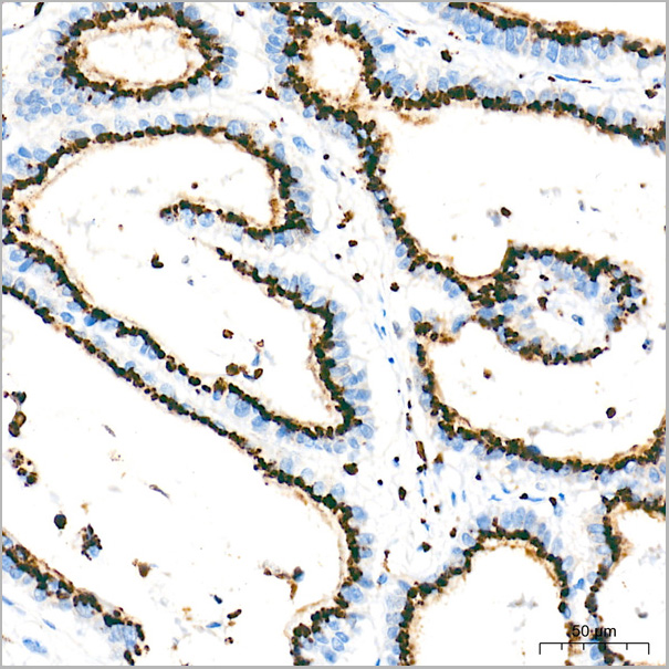 product-image-AAA28576_IHC2.jpg