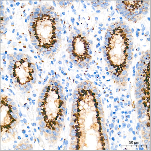 product-image-AAA28576_IHC3.jpg