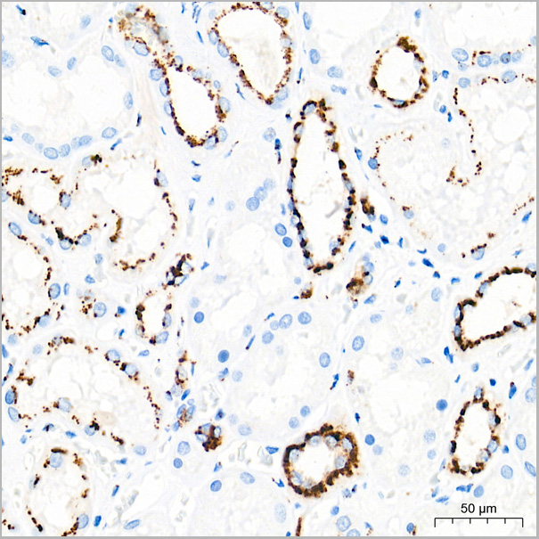product-image-AAA28576_IHC4.jpg