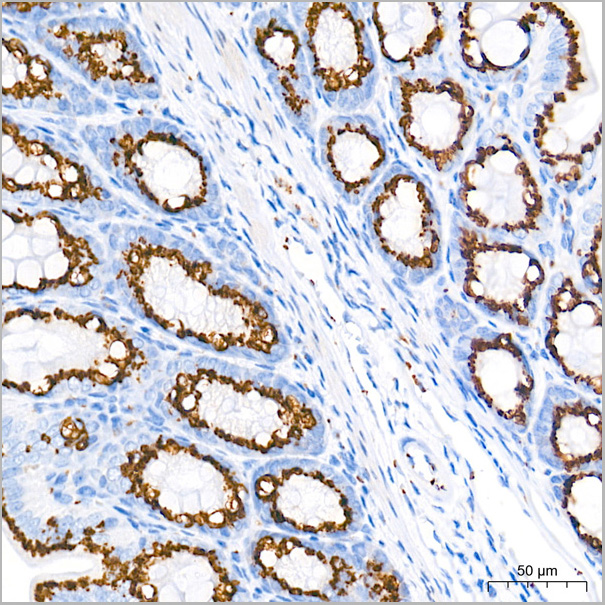 product-image-AAA28576_IHC5.jpg