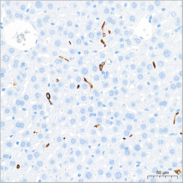 product-image-AAA28577_IHC5.jpg