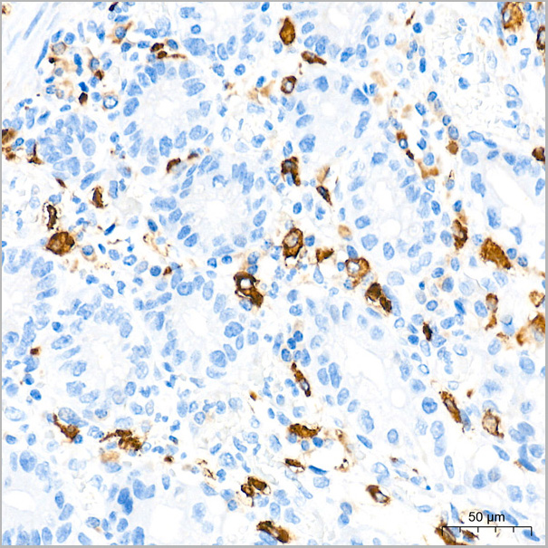 product-image-AAA28577_IHC8.jpg