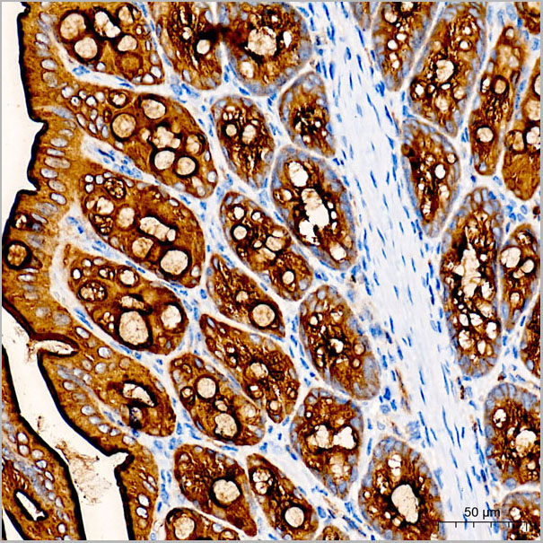 product-image-AAA28579_IHC2.jpg
