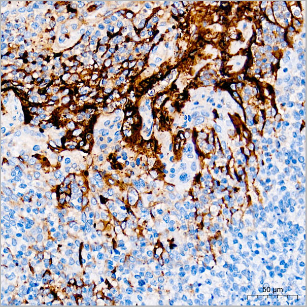 product-image-AAA28579_IHC3.jpg