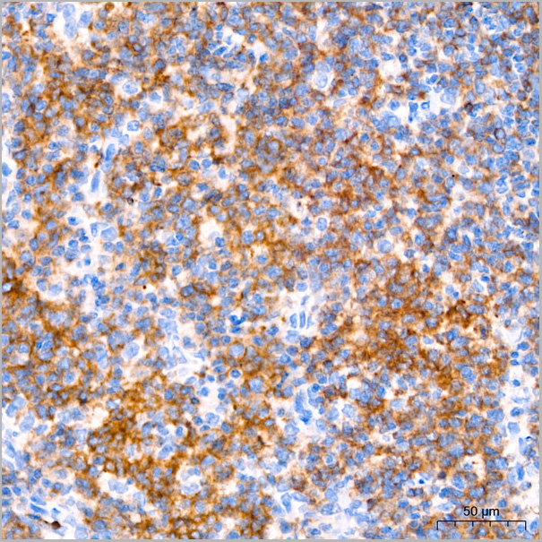 product-image-AAA28580_IHC2.jpg