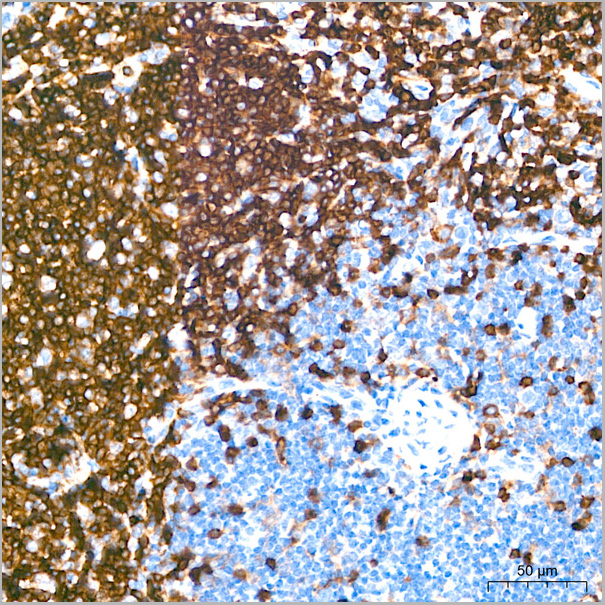 product-image-AAA28580_IHC3.jpg