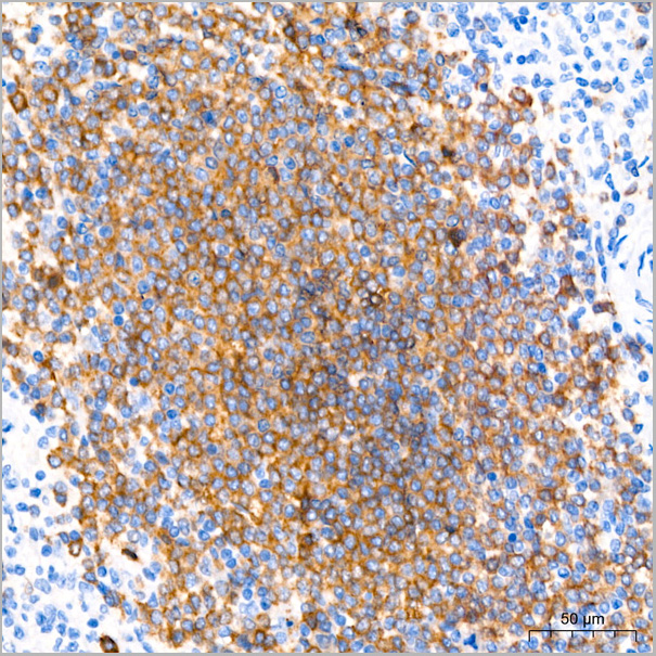 product-image-AAA28580_IHC4.jpg