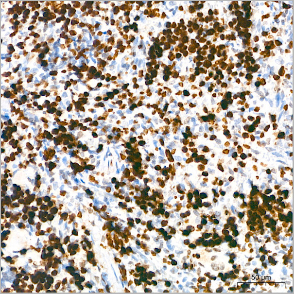 product-image-AAA28581_IHC5.jpg