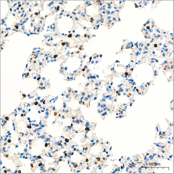 product-image-AAA28582_IHC2.jpg