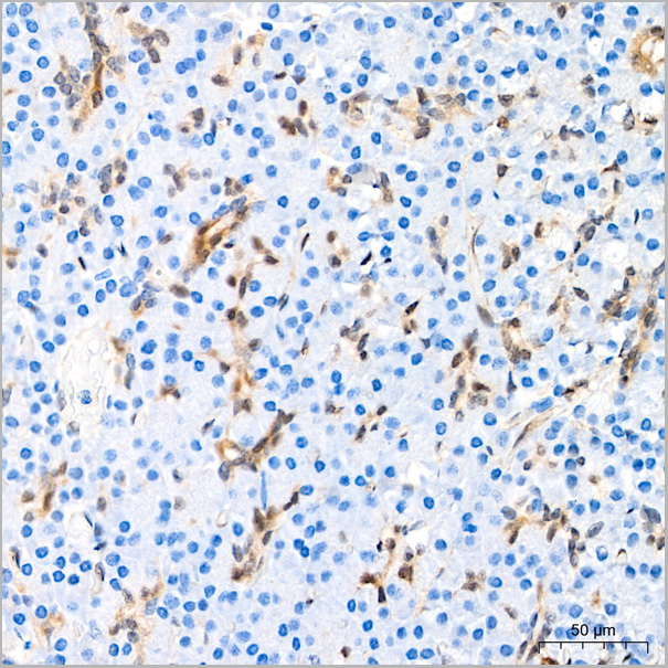 product-image-AAA28582_IHC4.jpg