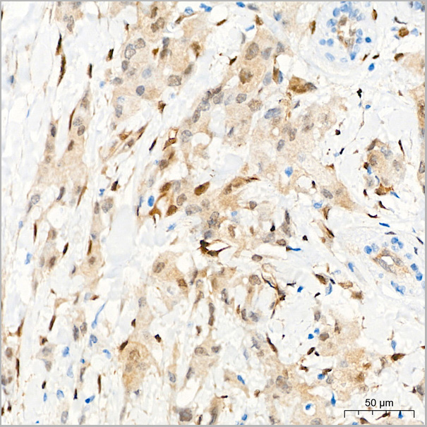 product-image-AAA28582_IHC5.jpg