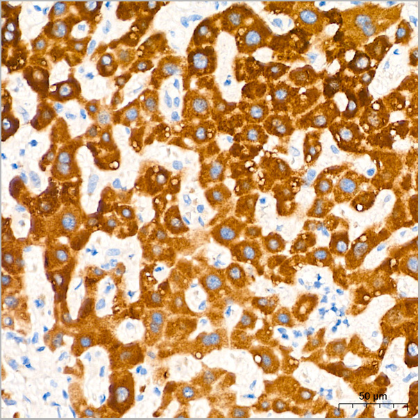 product-image-AAA28583_IHC3.jpg