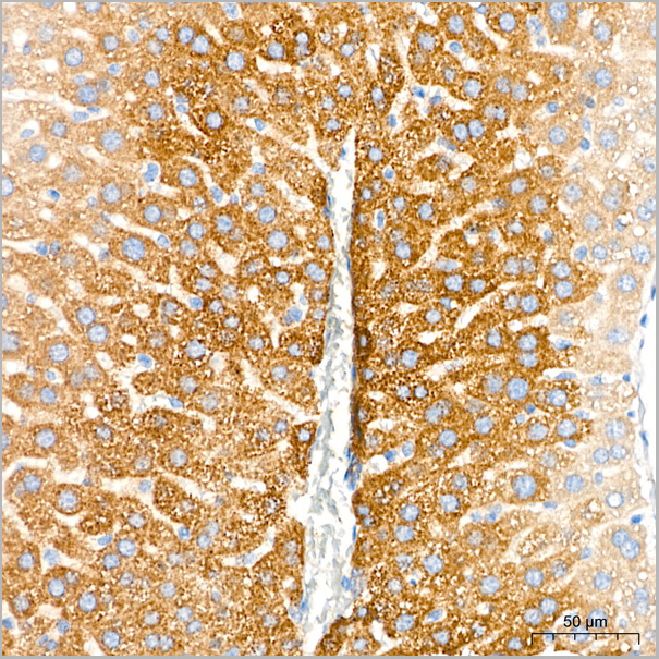 product-image-AAA28583_IHC4.jpg
