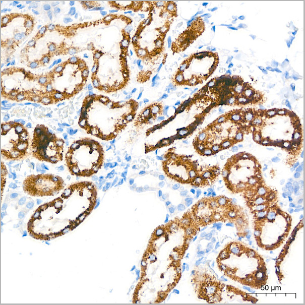 product-image-AAA28583_IHC5.jpg