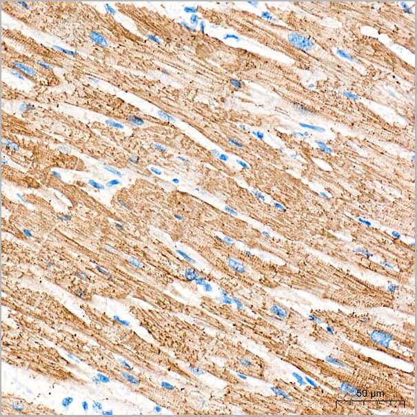product-image-AAA28584_IHC4.jpg