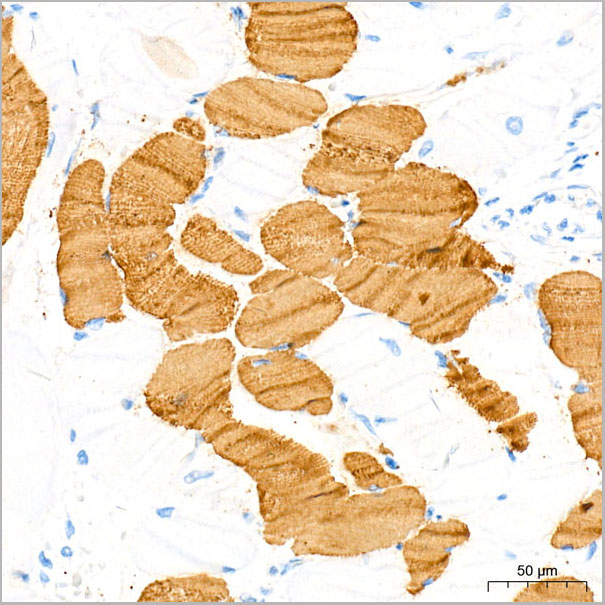 product-image-AAA28584_IHC5.jpg
