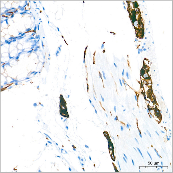 product-image-AAA28585_IHC8.jpg