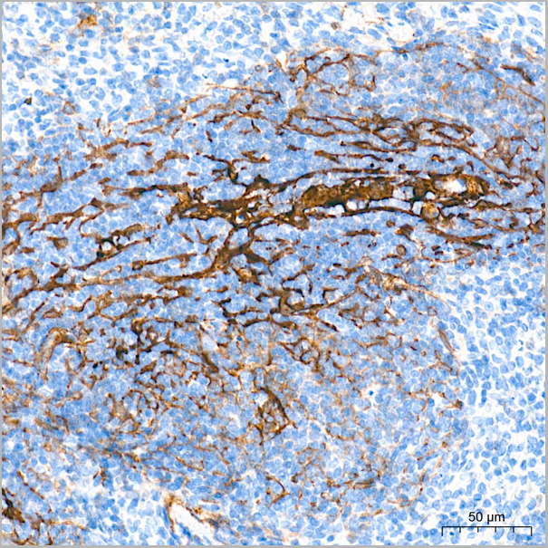 product-image-AAA28585_IHC9.jpg