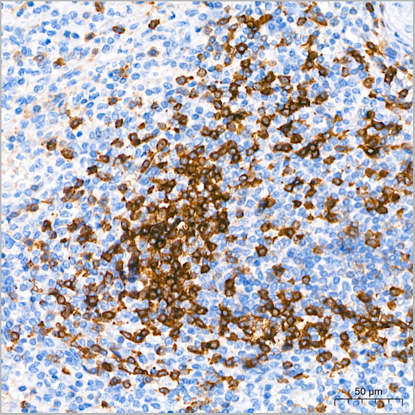 product-image-AAA28586_IHC3.jpg