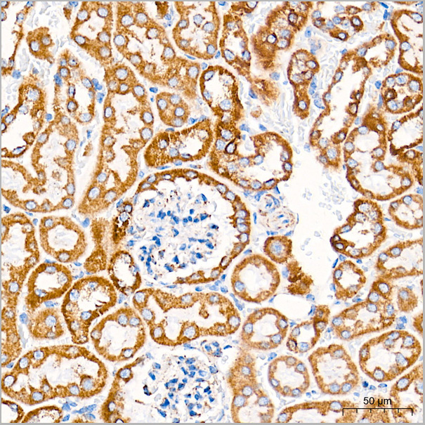 product-image-AAA28587_IHC6.jpg