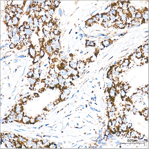 product-image-AAA28589_IHC2.jpg