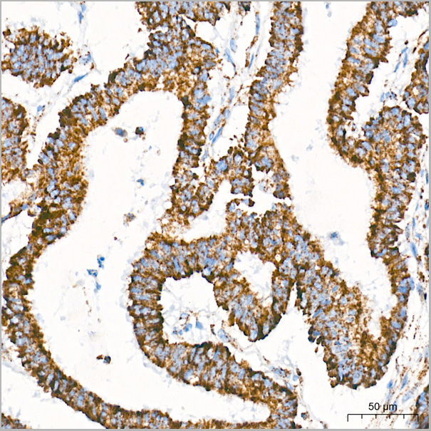 product-image-AAA28589_IHC3.jpg