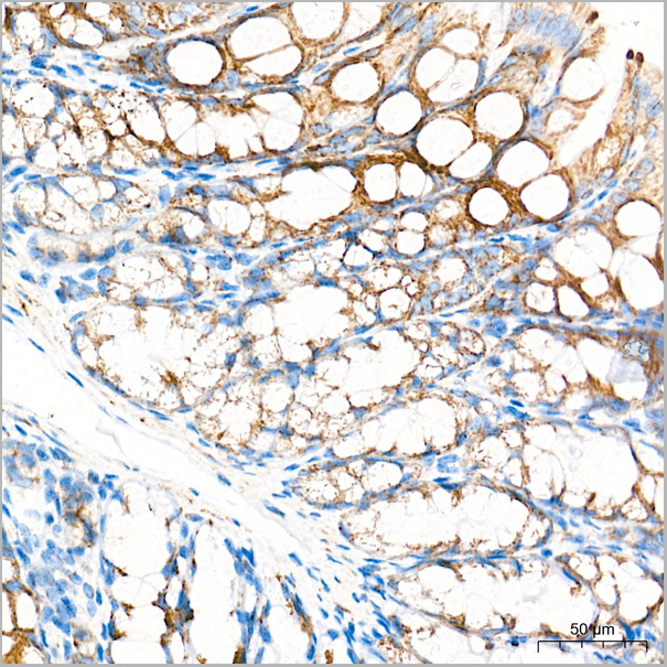product-image-AAA28589_IHC6.jpg