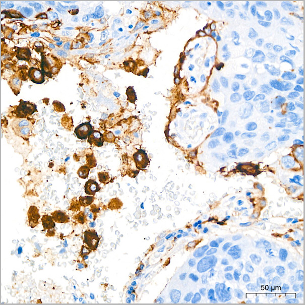 product-image-AAA28590_IHC2.jpg