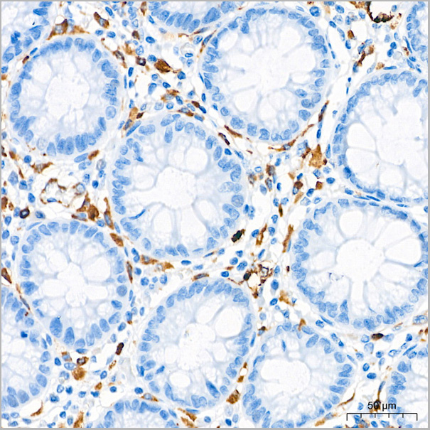 product-image-AAA28590_IHC3.jpg