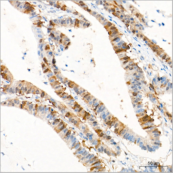 product-image-AAA28591_IHC2.jpg
