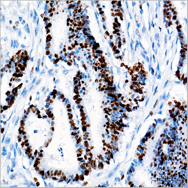 product-image-AAA28593_IHC4.jpg