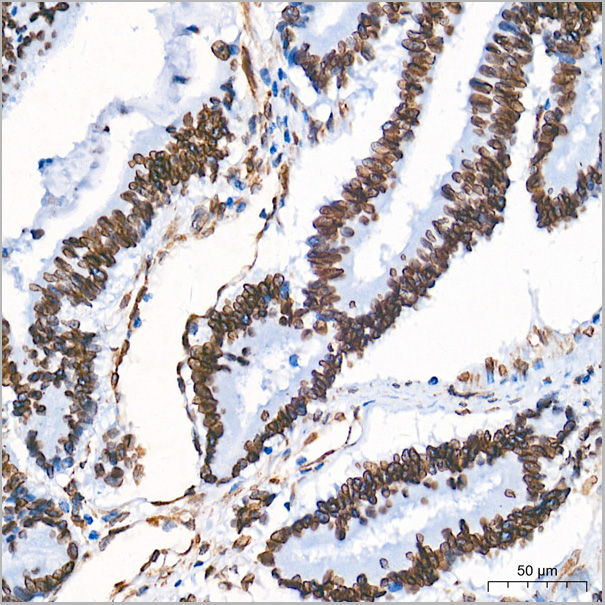 product-image-AAA28596_IHC3.jpg