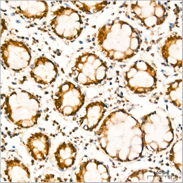 product-image-AAA28602_IHC3.jpg
