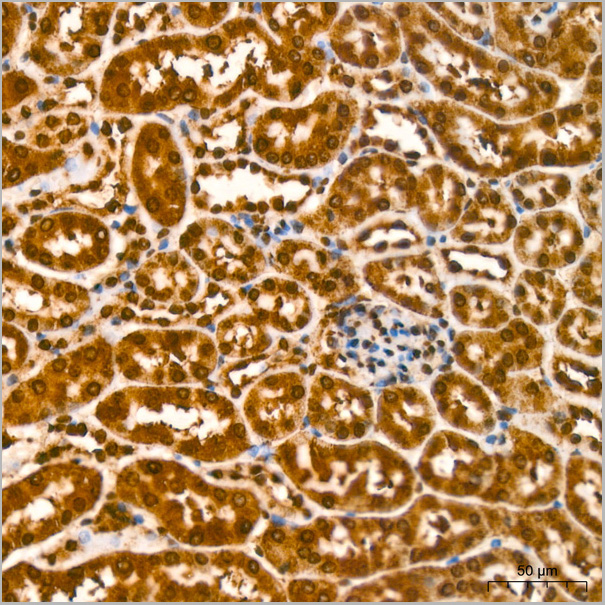 product-image-AAA28602_IHC5.jpg
