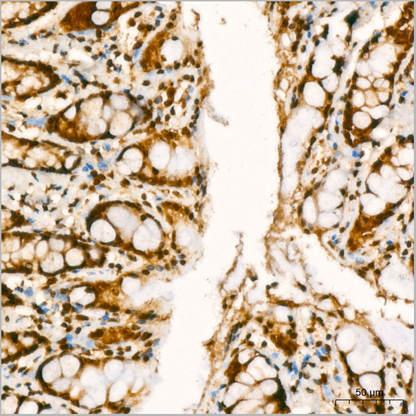 product-image-AAA28602_IHC6.jpg