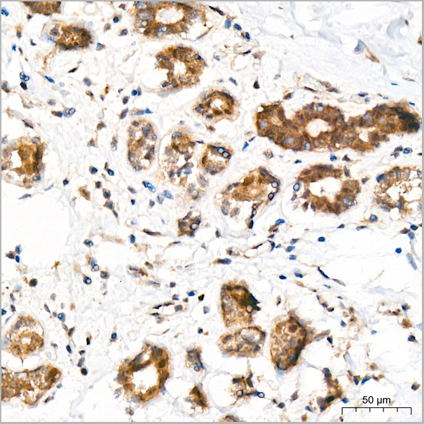 product-image-AAA28603_IHC3.jpg