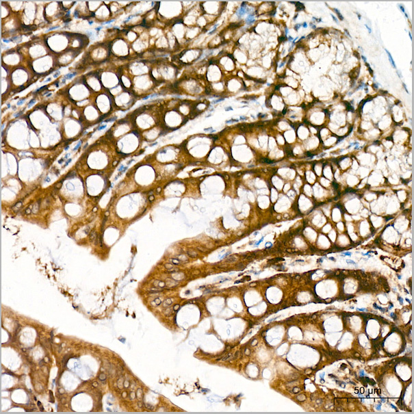 product-image-AAA28603_IHC4.jpg
