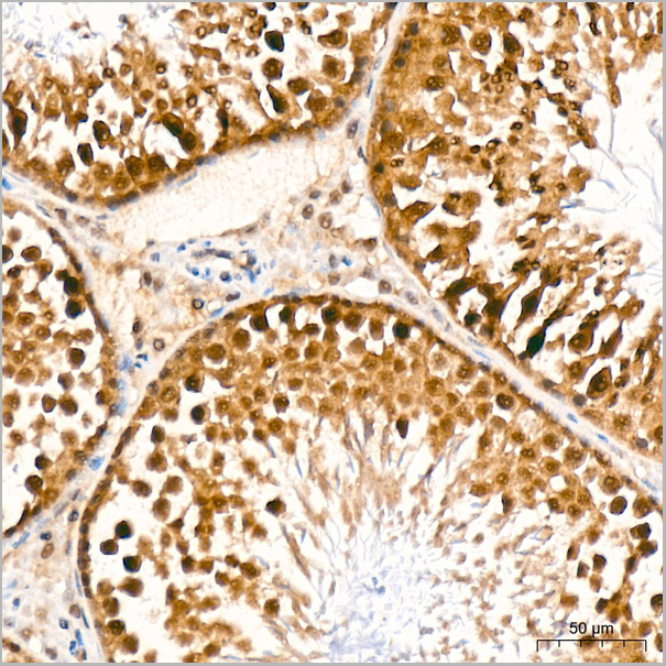 product-image-AAA28603_IHC6.jpg