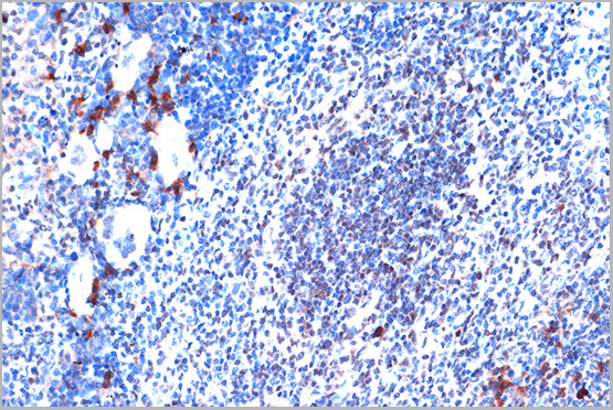 product-image-AAA28606_IHC4.jpg