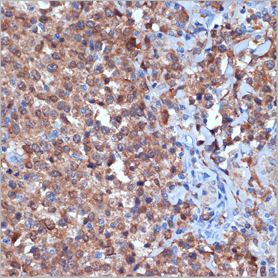 product-image-AAA28608_IHC2.jpg