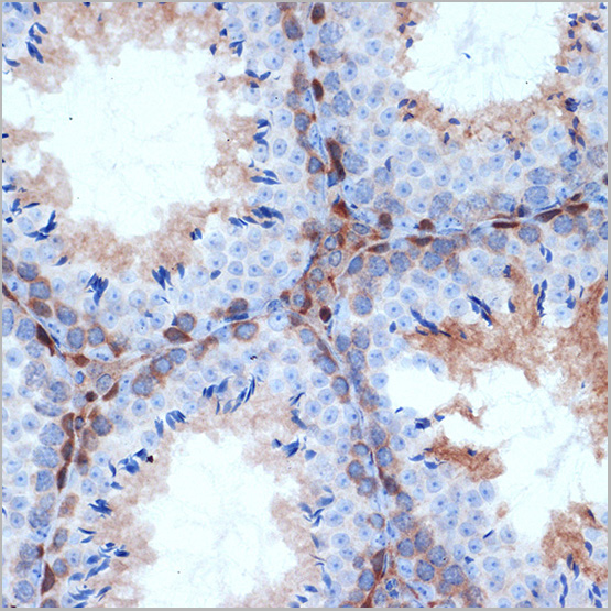 product-image-AAA28608_IHC3.jpg