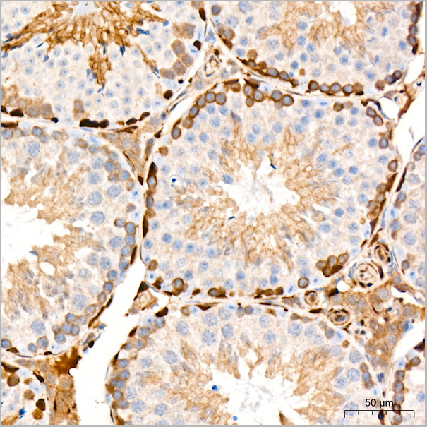 product-image-AAA28608_IHC6.jpg