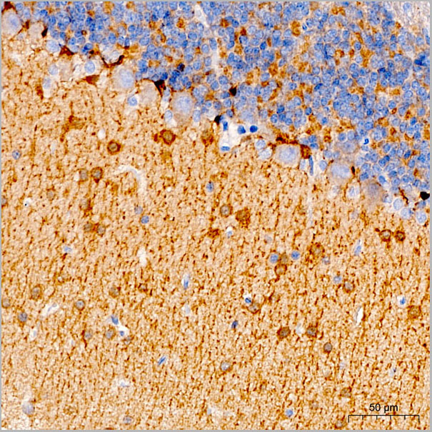 product-image-AAA28609_IHC3.jpg