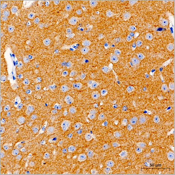 product-image-AAA28609_IHC4.jpg
