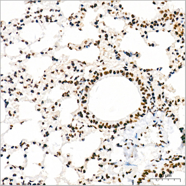 product-image-AAA28613_IHC2.jpg