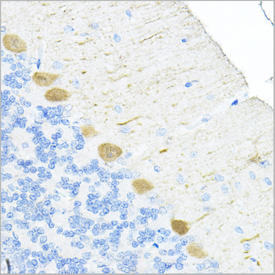 product-image-AAA28618_IHC3.jpg